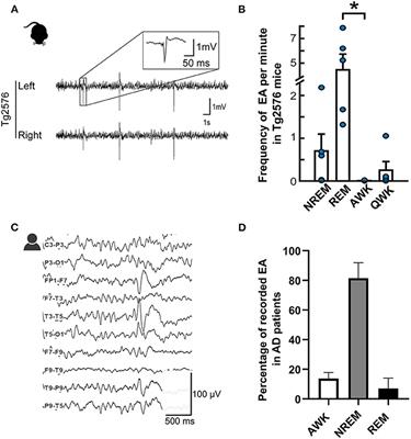 Sleep: The Tip of the Iceberg in the Bidirectional Link Between Alzheimer's Disease and Epilepsy